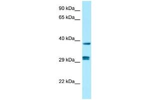 Image no. 1 for anti-Protein Phosphatase 1, Catalytic Subunit, beta Isoform (PPP1CB) (C-Term) antibody (ABIN2790275)
