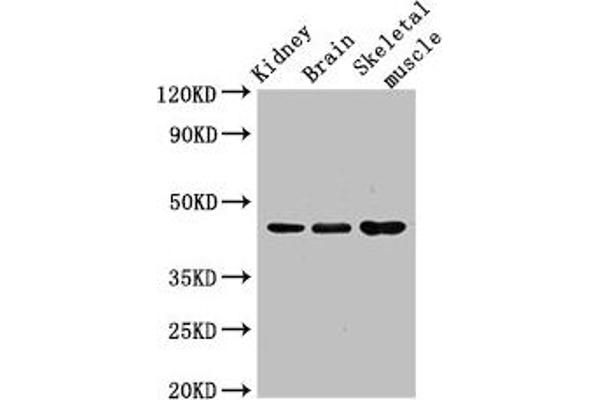 Caspase 4 antibody  (AA 82-226)