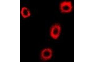 Image no. 1 for anti-Coatomer Protein Complex, Subunit beta 2 (COPB2) (full length) antibody (ABIN6005532)