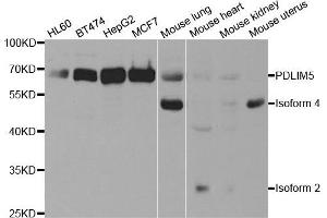 Image no. 1 for anti-PDZ and LIM Domain 5 (PDLIM5) antibody (ABIN2564457)
