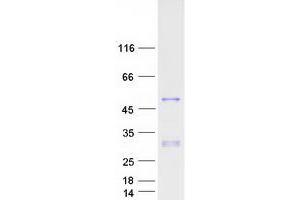 Image no. 1 for Paired Box Gene 2a (PAX2A) (Transcript Variant B) protein (Myc-DYKDDDDK Tag) (ABIN2728309)