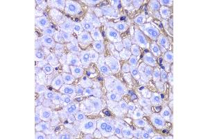 Image no. 4 for anti-Major Histocompatibility Complex, Class I, A (HLA-A) antibody (ABIN1873024)