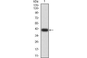 Image no. 1 for anti-rho GTPase Activating Protein 42 (ARHGAP42) (AA 577-719) antibody (ABIN5611366)