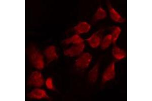 Image no. 1 for anti-Fibroblast Growth Factor 18 (FGF18) (Internal Region) antibody (ABIN6257179)