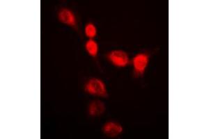 Image no. 1 for anti-Heterogeneous Nuclear Ribonucleoprotein A2/B1 (HNRNPA2B1) (N-Term) antibody (ABIN2707577)