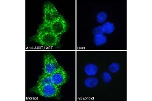 Image no. 1 for anti-Alanine Glyoxylate Aminotransferase (AGXT) (Internal Region) antibody (ABIN570702)