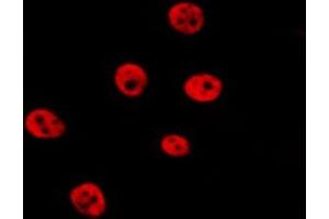 Image no. 4 for anti-Janus Kinase 2 (JAK2) (pTyr931) antibody (ABIN6256069)