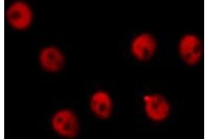 Image no. 17 for anti-REL proto-oncogene (c-Rel) (pSer503) antibody (ABIN6255382)