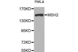 Image no. 4 for anti-Mismatch Repair Protein 2 (MSH2) antibody (ABIN3021477)