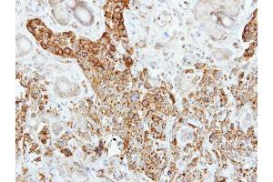anti-Pancreatic Lipase (PNLIP) (Center) antibody