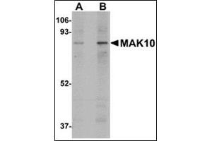 Image no. 2 for anti-MAK10 Homolog, Amino-Acid N-Acetyltransferase Subunit (MAK10) (Center) antibody (ABIN500222)