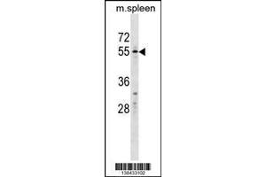 Image no. 1 for anti-WAP, Follistatin/kazal, Immunoglobulin, Kunitz and Netrin Domain Containing 2 (WFIKKN2) (AA 535-564), (C-Term) antibody (ABIN1537446)