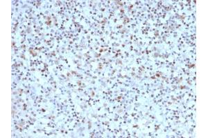 Image no. 4 for anti-B-Cell CLL/lymphoma 6 (BCL6) (AA 256-389) antibody (ABIN6940529)
