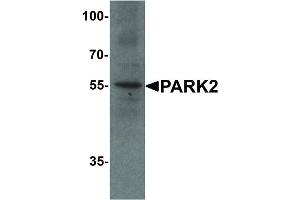 Image no. 3 for anti-Parkinson Protein 2, E3 Ubiquitin Protein Ligase (Parkin) (PARK2) (N-Term) antibody (ABIN6655555)
