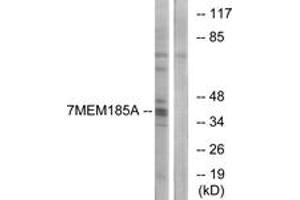 Image no. 1 for anti-Transmembrane Protein 185A (TMEM185A) (AA 290-339) antibody (ABIN1535999)