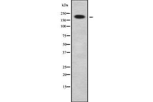 Image no. 1 for anti-Calmodulin Binding Transcription Activator 1 (CAMTA1) (Internal Region) antibody (ABIN6260441)