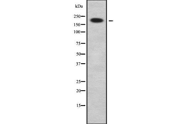 anti-Calmodulin Binding Transcription Activator 1 (CAMTA1) (Internal Region) antibody