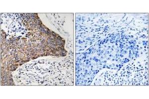 Image no. 2 for anti-Complement Component 1, Q Subcomponent Binding Protein (C1QBP) (AA 61-110) antibody (ABIN1534795)