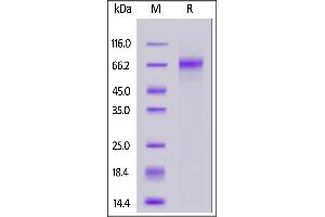 Image no. 2 for delta Like Protein 3 (DLL3) (AA 27-490) (Active) protein (His tag) (ABIN6992335)