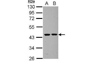 WB Image Sample (30 ug of whole cell lysate) A: U87-MG B: SK-N-SH 10% SDS PAGE antibody diluted at 1:1000