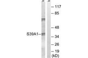 Image no. 1 for anti-Solute Carrier Family 39 (Zinc Transporter), Member 1 (SLC39A1) (AA 111-160) antibody (ABIN1535489)