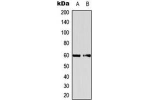 Image no. 1 for anti-Eukaryotic Translation Initiation Factor 2B, Subunit 4 Delta, 67kDa (EIF2B4) (Center) antibody (ABIN2972765)