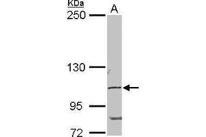 Image no. 5 for anti-POM121 Membrane Glycoprotein (POM121) (N-Term) antibody (ABIN2855297)
