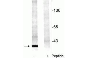 Image no. 2 for anti-14-3-3 alpha + beta (YWHAB) (pSer58) antibody (ABIN361482)