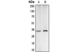 Image no. 1 for anti-Carbonic Anhydrase VA (CA5A) (Center) antibody (ABIN2705662)