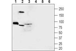 Western blot analysis of rat skeletal muscle (lanes 1 and 4), mouse kidney (lanes 2 and 5) and rat brain (lanes 3 and 6) lysates: - 1-3.