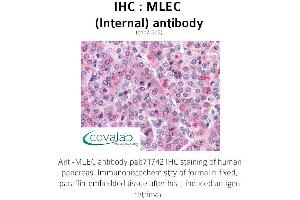 Image no. 1 for anti-Malectin (MLEC) (Internal Region) antibody (ABIN1736971)