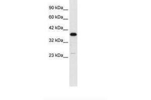 Image no. 2 for anti-Complement Component 4 Binding Protein, beta (C4BPB) (N-Term) antibody (ABIN6735849)