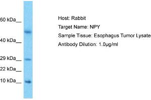 Image no. 1 for anti-Neuropeptide Y (NPY) (Middle Region) antibody (ABIN2777013)