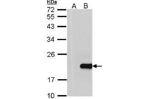 WB Image Western Blot analysis of HPCAL1 expression in transfected 293T cell line by HPCAL1 polyclonal antibody.