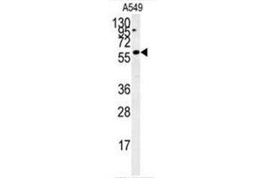 Image no. 1 for anti-PARP1 Binding Protein (PARPBP) (AA 529-558), (C-Term) antibody (ABIN950735)