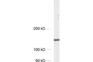 Image no. 2 for anti-Amyloid beta (A4) Precursor Protein-Binding, Family A, Member 1 (APBA1) (AA 2-265) antibody (ABIN1742315)