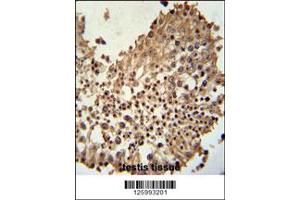 Immunohistochemistry (IHC) image for anti-Coiled-Coil Domain Containing 42 (CCDC42) antibody (ABIN2158082)