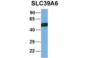 Image no. 4 for anti-Solute Carrier Family 39 (Zinc Transporter), Member 6 (SLC39A6) (Middle Region) antibody (ABIN2781630)
