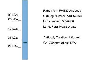 Image no. 2 for anti-RAB35, Member RAS Oncogene Family (RAB35) (Middle Region) antibody (ABIN2784852)