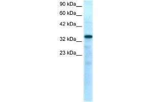 Image no. 1 for anti-T-Box 10 (TBX10) (N-Term) antibody (ABIN2779398)