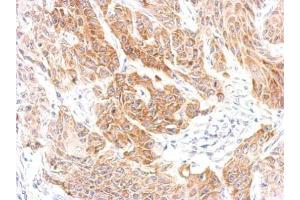 IHC-P Image CXCR6 antibody [N2C1], Internal detects CXCR6 protein at cytosol on Cal27 xenograft by immunohistochemical analysis.