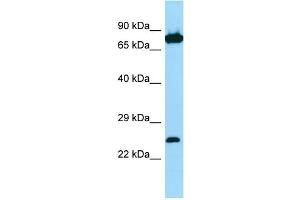 Image no. 2 for anti-Sorting Nexin 27 (SNX27) (C-Term) antibody (ABIN2790135)