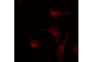 Image no. 2 for anti-N-Terminal EF-Hand Calcium Binding Protein 3 (NECAB3) (Internal Region) antibody (ABIN6258487)