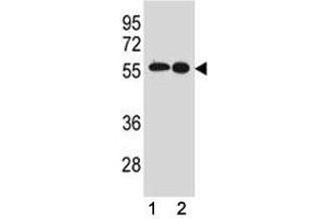 Image no. 4 for anti-Proto-oncogene tyrosine-protein kinase Src (Src) (AA 24-52) antibody (ABIN3029554)