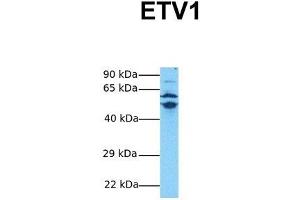 Image no. 4 for anti-Ets Variant 1 (ETV1) (Middle Region) antibody (ABIN2780627)