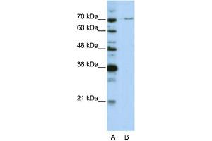 Image no. 1 for anti-PRP3 Pre-mRNA Processing Factor 3 Homolog (PRPF3) (N-Term) antibody (ABIN2778910)