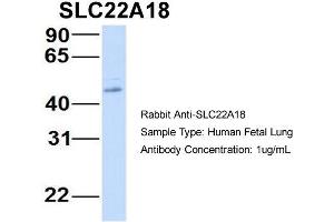 Image no. 2 for anti-Solute Carrier Family 22 Member 18 (SLC22A18) (N-Term) antibody (ABIN2781574)