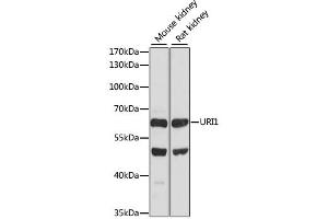 Image no. 1 for anti-URI1, Prefoldin-Like Chaperone (URI1) antibody (ABIN6293701)