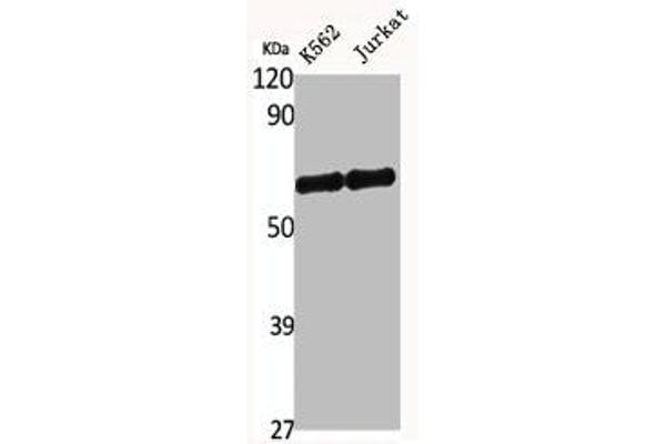 DCLRE1B Antikörper  (C-Term)