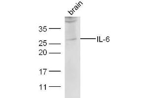 Image no. 3 for anti-Interleukin 6 (IL6) (AA 26-50) antibody (ABIN728068)